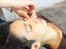 ミノリノモリ(Minorinomori)の雰囲気（美容鍼で小顔×たるみ×むくみ×自律神経同時ケア！即効&長持ち!）