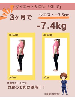 キリグ(KILIG)の写真/話題の痩身エステで叶う理想のくびれ！リバウンドしない身体へ3ヶ月で体重-7.4kgの痩身実績多数◎