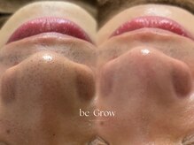 ビーグロウ(be Grow)の雰囲気（しっかり根本から肌質改善☆ハーブピーリング/毛穴洗浄）