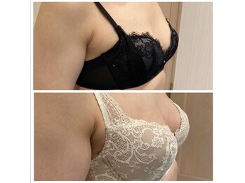 ソラ(sora)/産後バストも諦めないで★