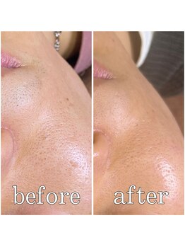 4515/お客様Before After