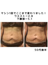 エクレボーテ(ECOULERBEAUTE)/マシンとリンパ　お腹