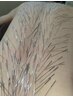 【鬼美容鍼　顔＋全身】気になる部位が数か所ある方　全身も整えます
