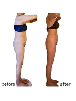 エミナル(EMINALu)/腰肉だってのがさない