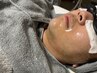 【サロン一押し】ヒゲ脱毛+ピンポイントのアタッチメント付きプラン」 
