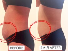 パリライム(parislime)/妊娠線/肉割れ/ストレッチマーク