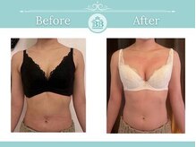 美人バスト 新潟店/ 【バストアップ★育乳】症例