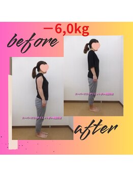スーパースリムダイエット茅ヶ崎 茅ヶ崎整体院/3ヵ月－6,0ｋｇ減ダイエット♪