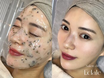 サロンドエクラル(Salon de Eclale wax)/【人気】艶肌waxで即艶肌