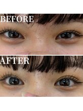 シナプスケアセンター 十三院(SYNAPSE CARE CENTER)/【シナプス療法】でパッチリと！