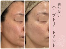 メシェリー(mecherie)の雰囲気（翌日～さらに変化を実感を頂けるハーブスピアを丁寧に入れ込み）