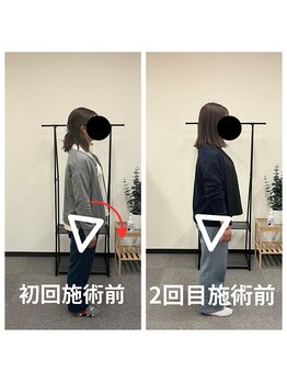 熊本カワル整体 JR上熊本駅院/継続は力なり