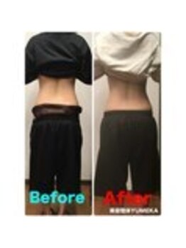 ユメカ 日の出院(YUMEKA)/骨盤ダイエット+骨盤ストレッチ