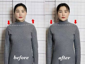 プーラビタ(PURAVITA)の写真/猫背・姿勢の歪み等、自分の姿勢が気になる方必見！18年の実績で施術！美しい姿勢になりましょう！！
