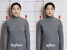 プーラビタ(PURAVITA)