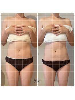 プルクレ 常磐町店(Pulchre)/ビフォーアフター♪