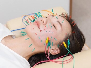 ピアーズ鍼灸整骨院の写真/美容鍼で顔に関係するツボに的確に刺激を与え、下がった筋肉を引き上げるからナチュラルにリフトアップ!