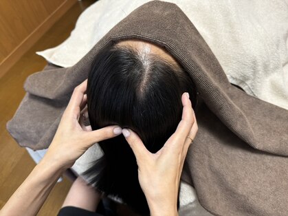 スーパースカルプ 熊本宇城店(SuperScalp)の写真