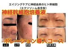 ハナン(Hanan)/結果重視!幹細胞ポレーション