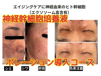 ハナン(Hanan)/結果重視!幹細胞ポレーション