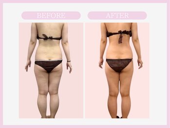 スリムライン 弘前店(The Slim Line)/before→after