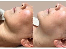 ウォナ(WONA)/【お客様症例】