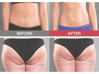 ブライトプラス 姫路店(Bright plus)の写真