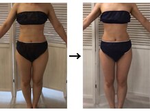 ドクターエイジレス(DR.AGELESS)/食べファスコース1ヶ月/3ヶ月