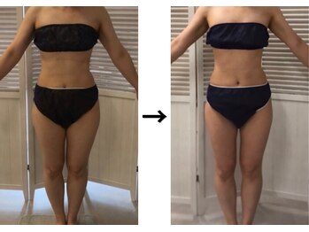 ドクターエイジレス(DR.AGELESS)/食べファスコース1ヶ月/3ヶ月