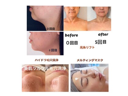 アトリエドゥアージュ(Atelier de age)の写真