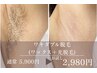 【ワキワックス＋光美肌脱毛】　¥4,950→¥2,980 &nbsp;&nbsp;