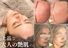 バーガルサロンギンザ(VAGAL SALON GINZA)