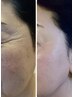 【たるみ|ハリ不足|くすみ】若々しさと透明感を引き出す韓国式肌管理