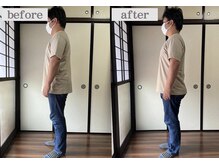 ミントのかべの整体院/姿勢矯正ビフォーアフター