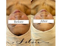 ソルヴィス(SOLVIS)/