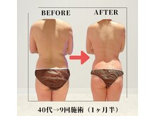 フェムビー 千葉駅前店(FEMBE)の雰囲気（【上半身痩せ】頑固な凝りも厚みもスッキリ解消！-10歳 ボディへ）