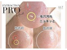 ウルト アルティメイトスキン(ULT ultimate skin)の雰囲気（毛穴エクストラクションでいちご鼻・黒ずみ・脂性肌卒業◎）