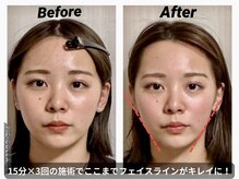 ショウフェイスデザイン(Sho Face Design)