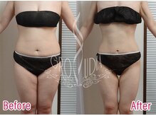 グラウディア 恵比寿/痩身/筋膜リリース/ブライダル