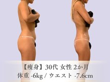 ベルペール(Belle perle)/【痩身】インドエステ