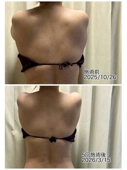 クールスパ(COOL SPA)/【100カップチャレンジ経過】