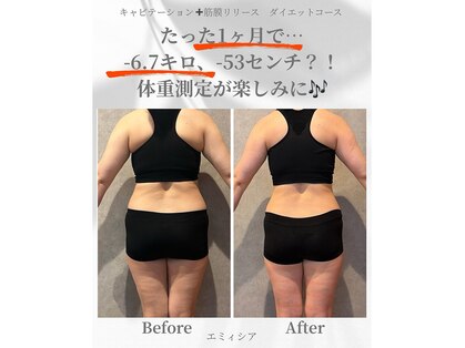 エミィシア(Emisia)の写真