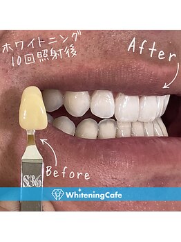 ホワイトニングカフェ 苫小牧店(WhiteningCafe)の写真/【メンズ来店多数◎】喫煙/コーヒー/蓄積汚れを結果重視のホワイトニングでリセット