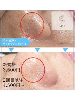 テンドット(ten.)/