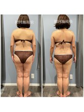 サロンドフィル(Salon de fil)/リンパマッサージでむくみ減少