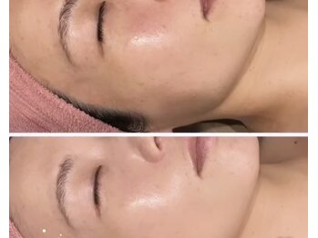 スターリィ スカイ(Starry☆Sky)/【フェイシャル】