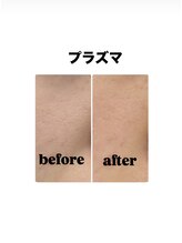 ナルフロウ(nalufurou)/プラズマ導入