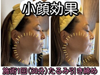 エバーグリーン(Evergreen)