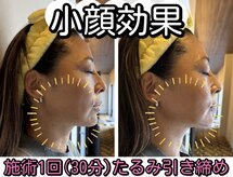 エバーグリーン(Evergreen)