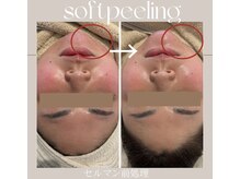 ヴェルソー(Verseau)